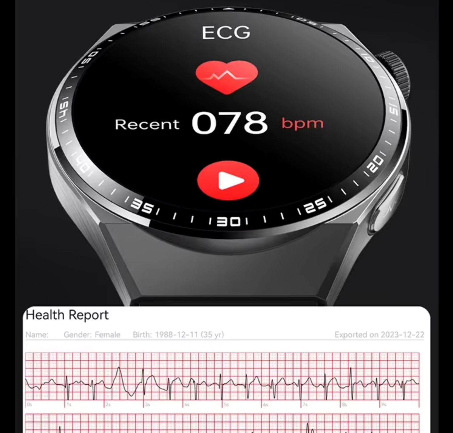 On-wrist ECG recording and health report from the REXQU O2Max