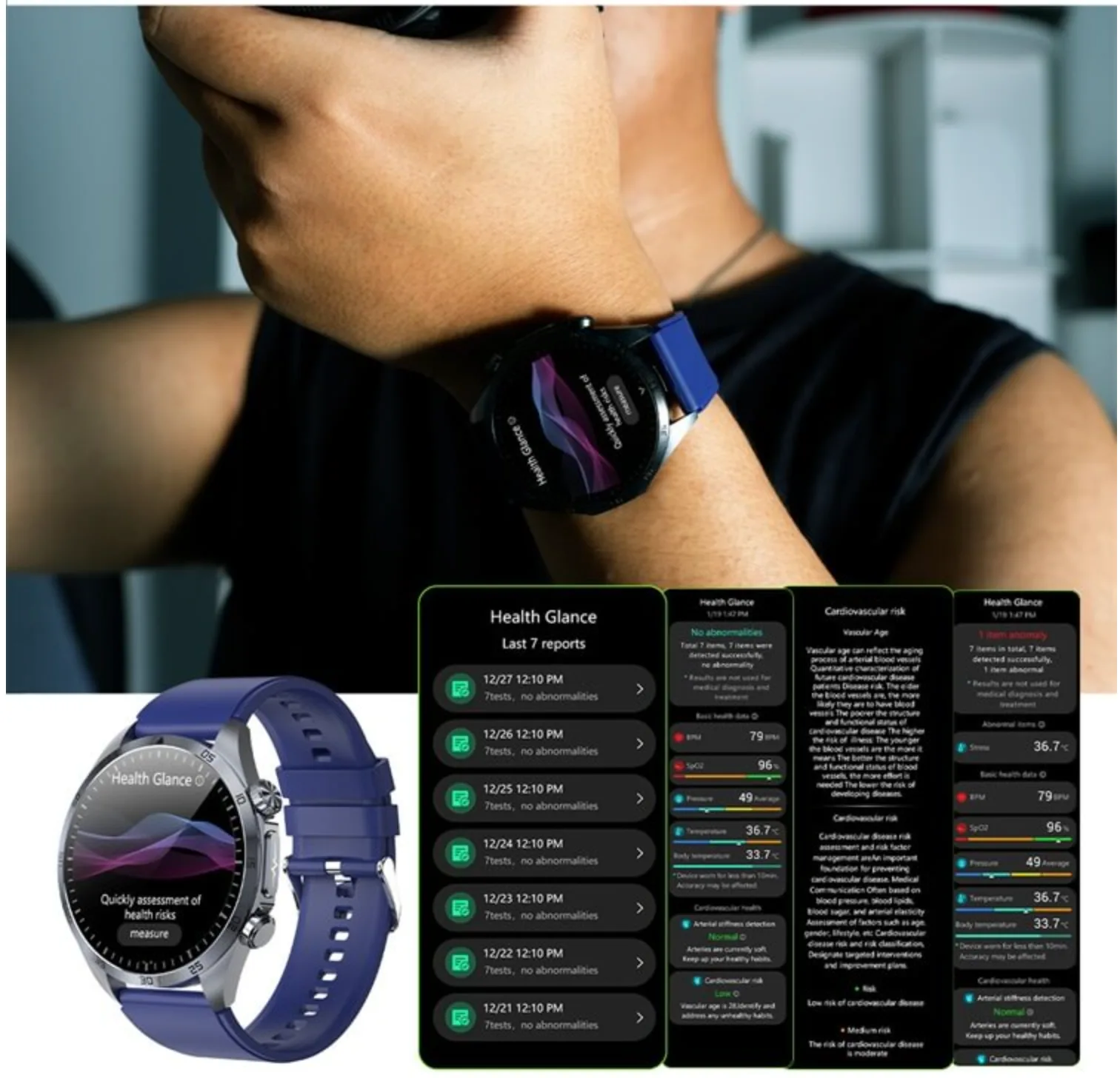 On-wrist ECG recording with the REXQU CoreX Pro