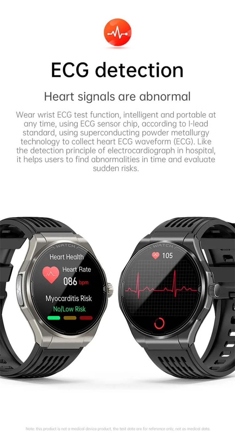 On-wrist ECG recording with the REXQU Chronex
