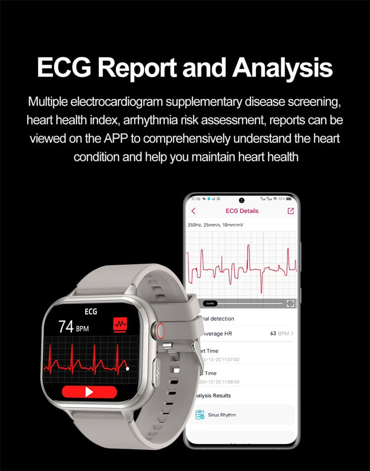 ECG report and analysis on the REXQU IntelliFit