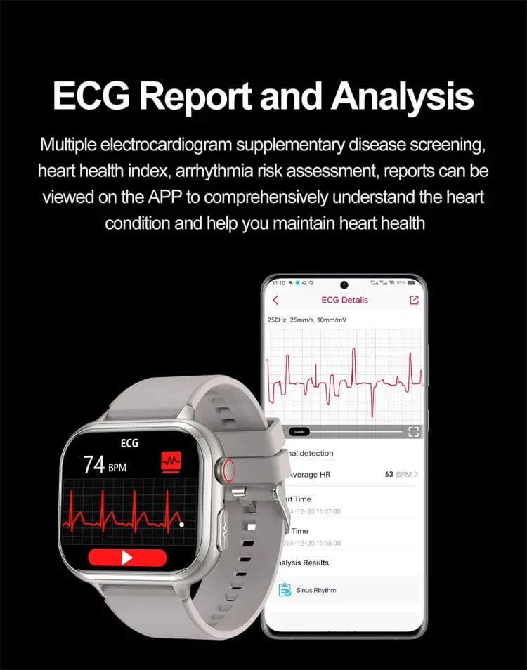 ECG report and analysis on the REXQU IntelliFit