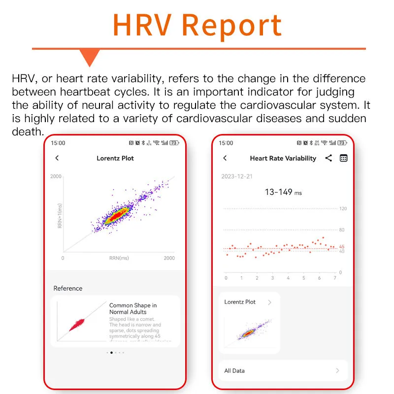 REXQU O2Max HRV report with Lorentz plot in the companion app
